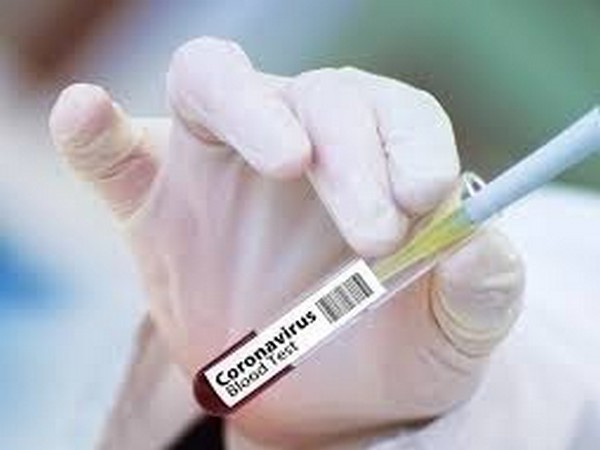 US daily death toll from COVID-19 tops 3000