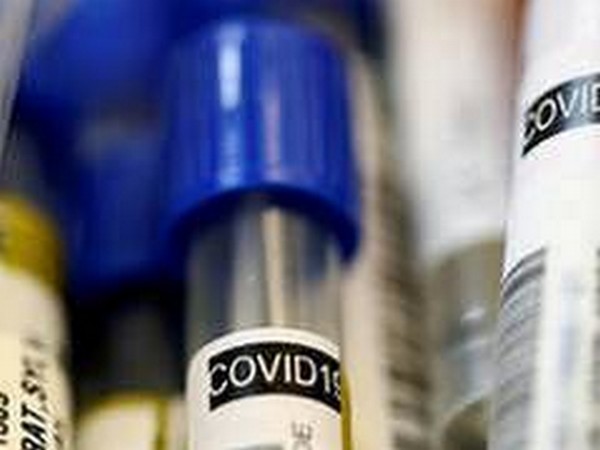 Turkey reports 7,656 new COVID-19 cases