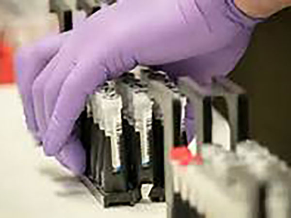 Experimental coronavirus drug remdesivir shows promise in Chicago trial, report says