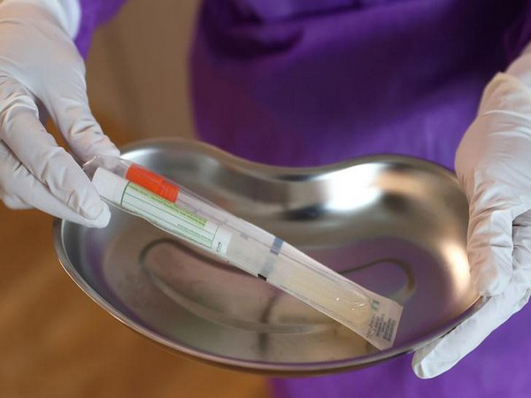 Govt. to back drug study to treat virus patients