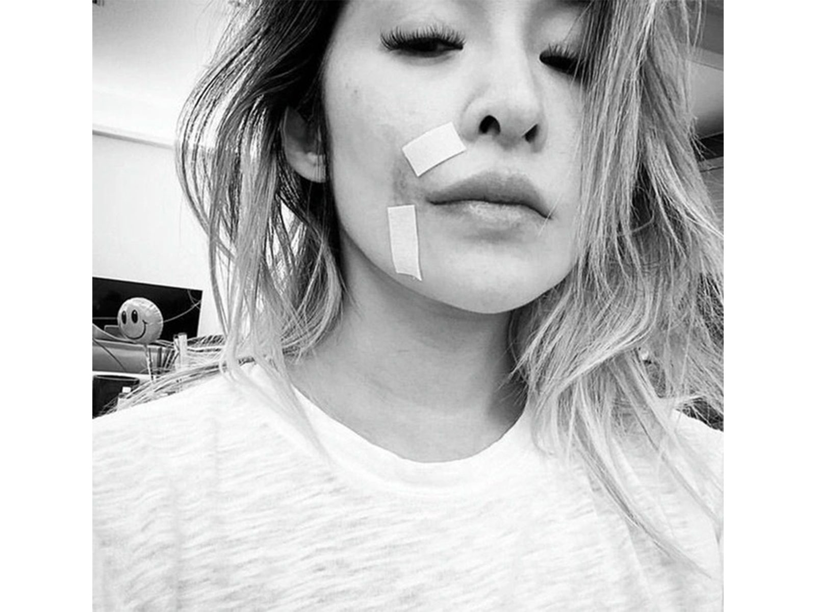 Representative image