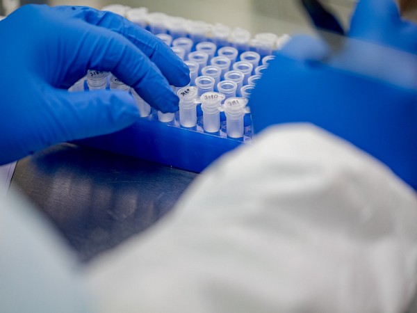 New virus cases under 400 on less testing; potential resurgence still worrisome