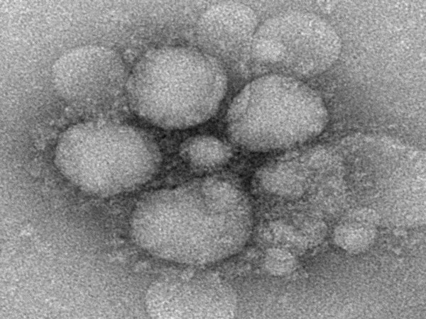 Airline passengers travelling from China screened for new coronavirus