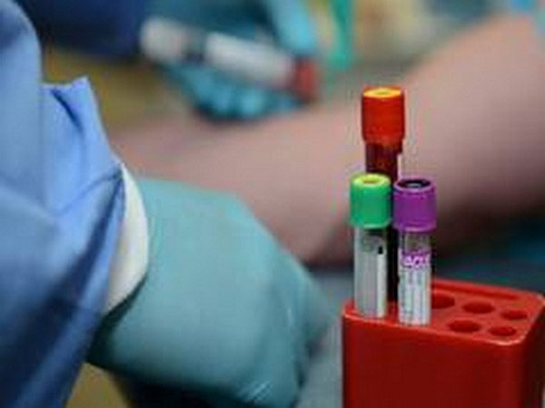 Strategies to prevent COVID-19 spread need constant reviewing as cases rise - Task Force