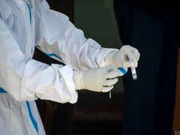 UK records another 20,572 coronavirus cases with 156 deaths