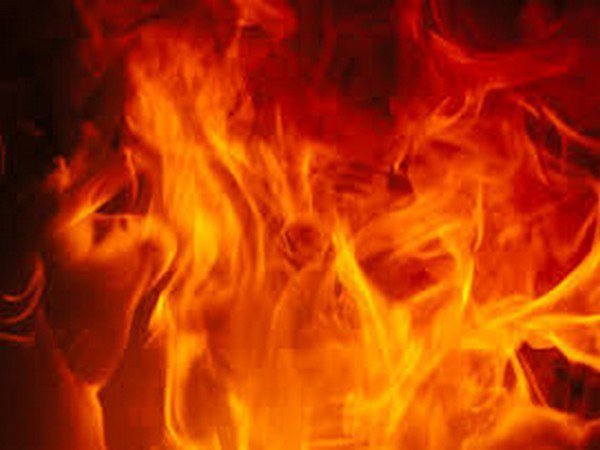 Quebec man charged with attempted murder after ex-wife allegedly set on fire