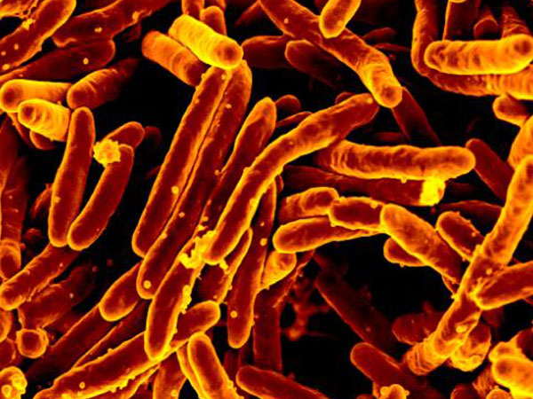 Suspected tuberculosis outbreak at Ecuador prison kills 10 inmates