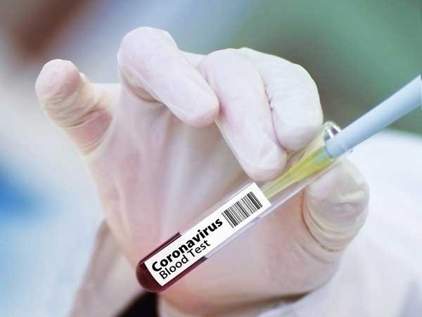 U.S. California hits grim milestone of 10 mln confirmed COVID-19 cases