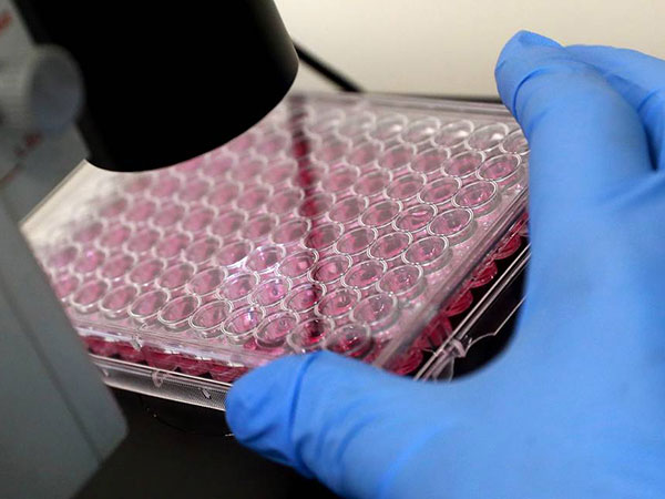 Russia ready to supply Ebola vaccine to Africa