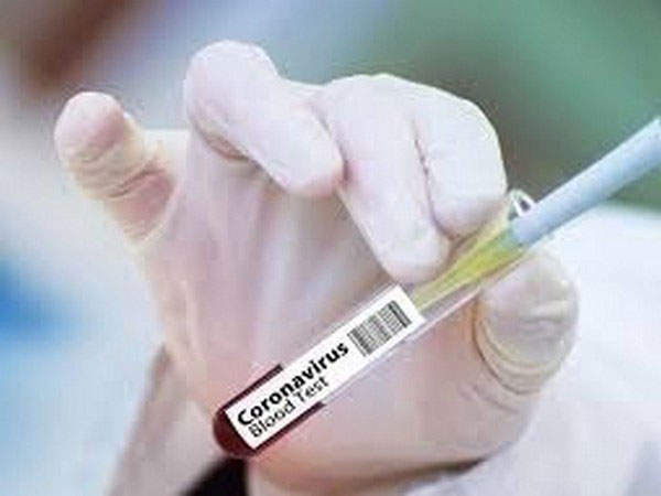 Hours-long lines for COVID-19 testing in Kingston, Ont., following outbreak
