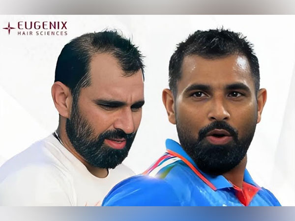 Mohammed Shami's incredible hair transformation with Eugenix Hair Sciences