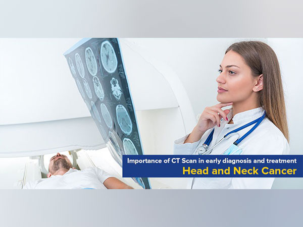 Head and Neck Cancer: Importance of CT Scan in Early Diagnosis and Treatment