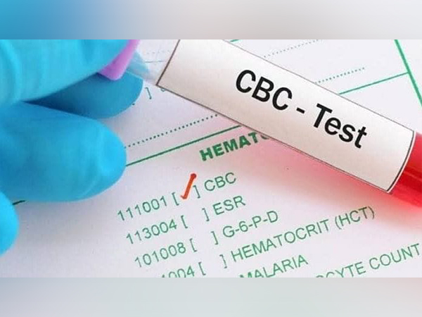 Signs You Require a CBC Test