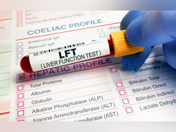 When Should You Get Liver Function Tests Done? Signs and Symptoms that Warrant Testing