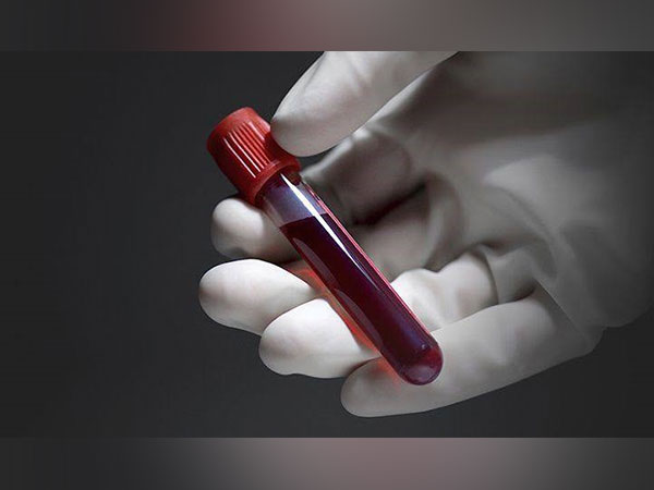 Which Blood Test Can Help Detect Infections?