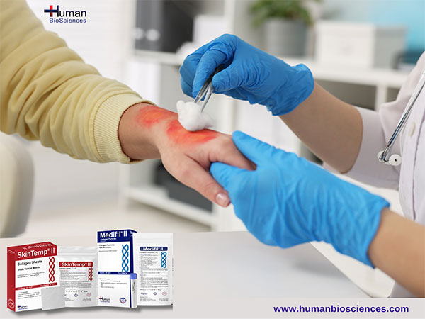 Modern wound care products put patients healing first