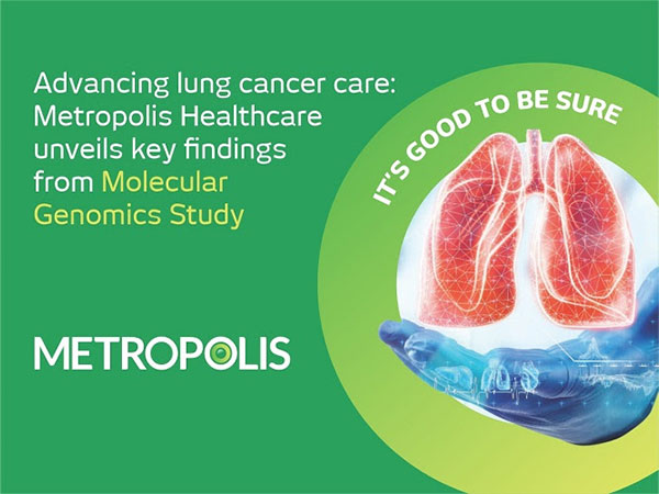 Molecular Genomics Study highlights the role of Next-Generation Sequencing (NGS) in lung cancer treatment