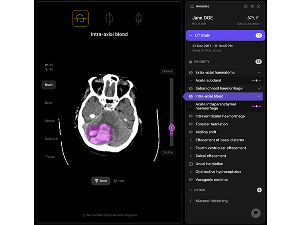 Aarthi Scans adopts Australian AI technology to elevate patient care management