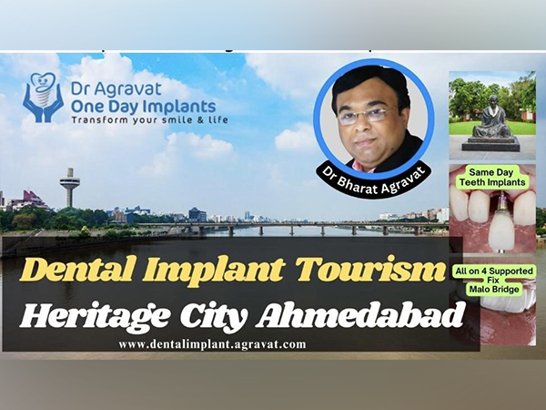 Dr Agravat Dental Implants Tourism Grows and Booms in the Indias First Heritage City Ahmedabad