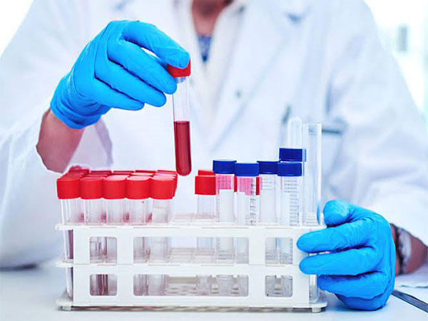 Getting sick frequently? Book a CBC test to know the cause