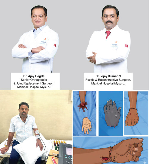 Manipal Hospitals, Mysuru successfully performed a complex hand replantation surgery