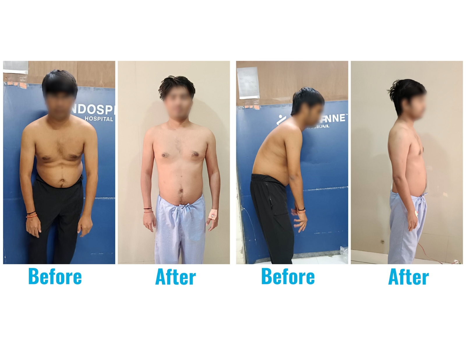 A 31-year-old who lived on a chair... until his spine finally said, 'Enough'