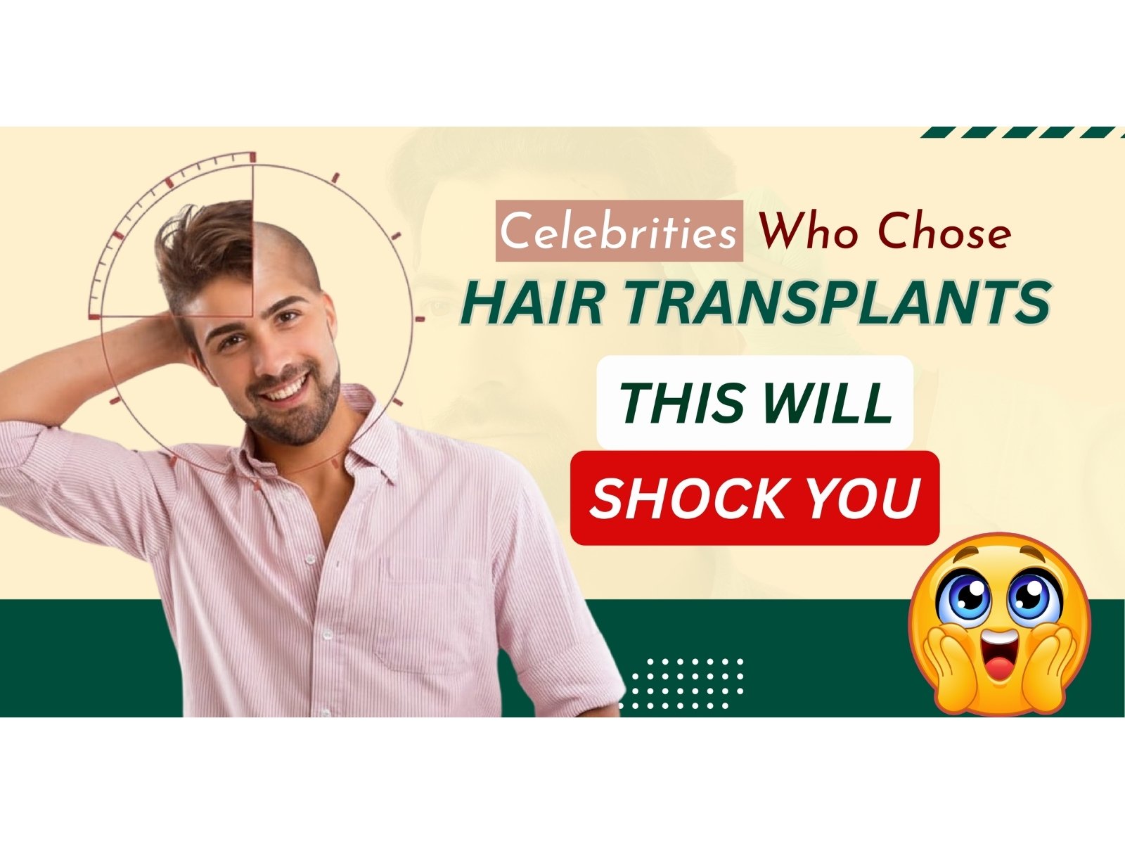 Celebrity Hair Transplant: You'd Never Guess They Had a Hair Transplant- But They Did