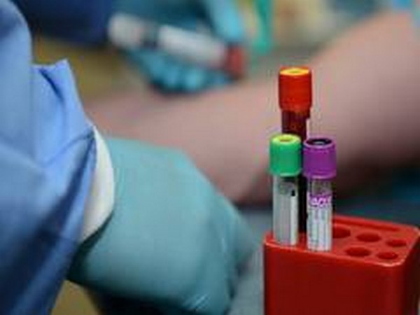 World watches intently as UK begins COVID-19 vaccination programme from Tuesday