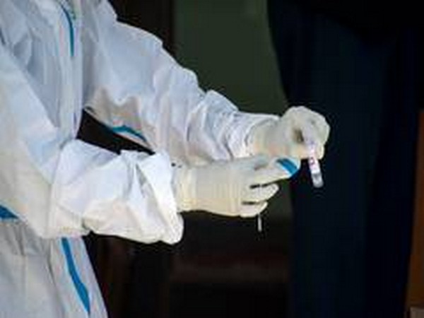 COVID-19 cases in Germany surpasses 1 million