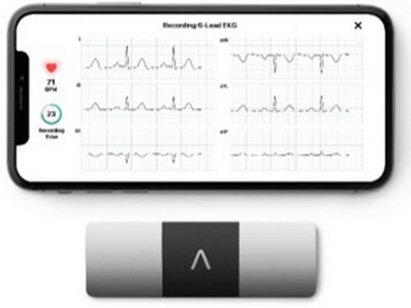 AliveCor brings the world's only six-lead, FDA-cleared personal ECG to India