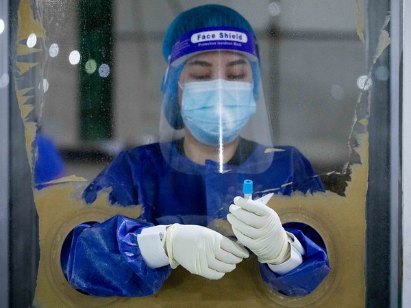 Brazil's COVID-19 death toll tops 170,000