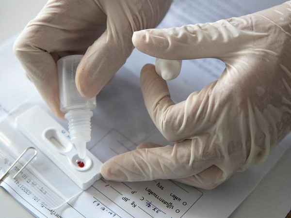 UK records another 17,272 coronavirus cases, 231 deaths