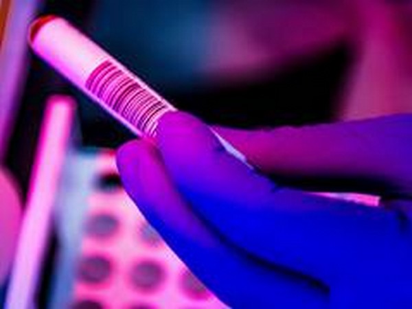 UAE develops rapid COVID-19 laser testing technology that gives results in seconds, will enable much faster mass screenings