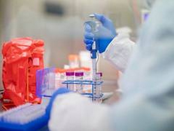 Belgium registers over 10,400 new COVID-19 cases, highest daily rise