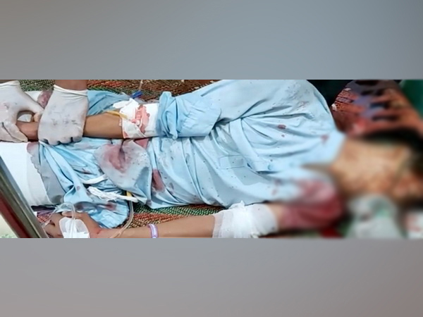 Teenager falls in deep ditch, dies after being chased by police in PoK's Kotli