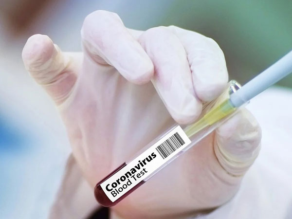 How Singapore, India are contributing to a COVID-19 vaccine race