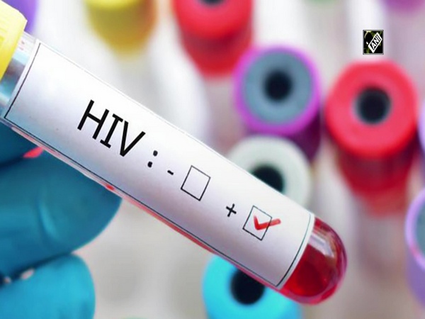 People with HIV at higher risk for heart failure: Study