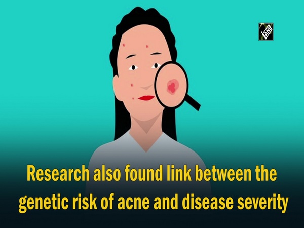 Study of genetics discovers new acne risk genes, provides hope for new treatment