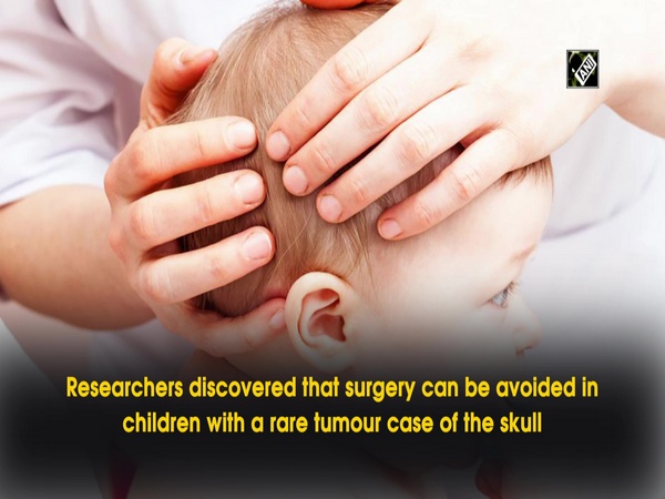 Study reveals surgery may be avoided for children with rare skull tumour