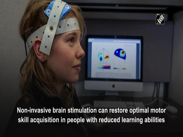 Older adults' motor skill development is improved by brain stimulation