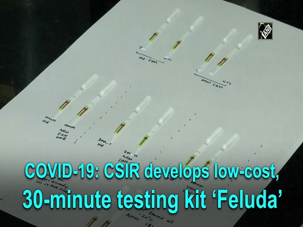 COVID-19: CSIR develops low-cost, 30-minute testing kit ‘Feluda’